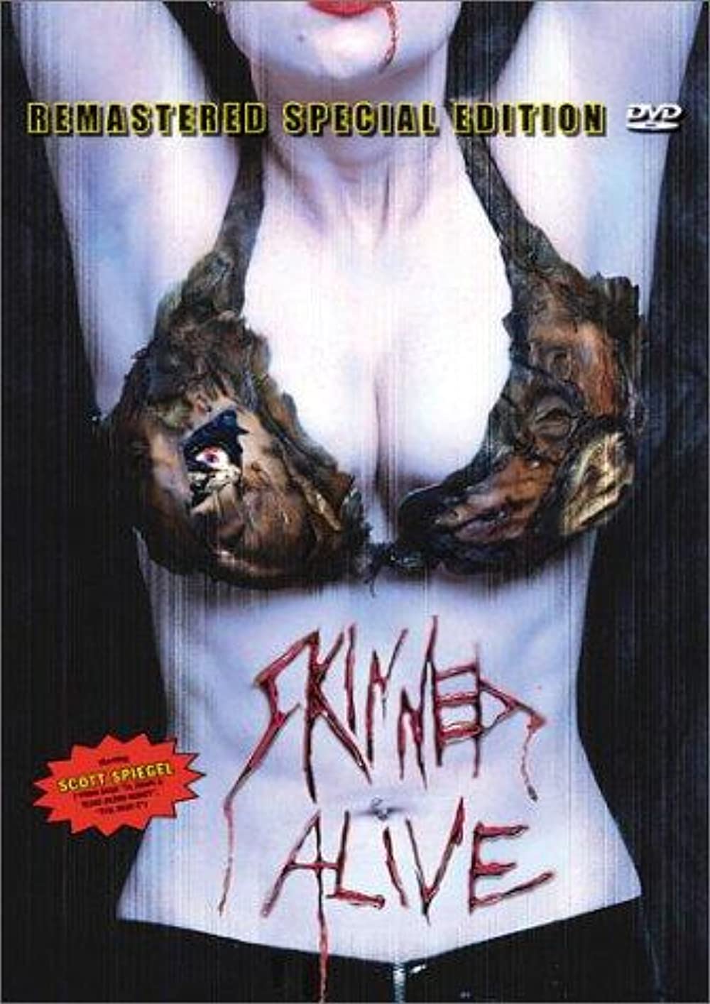 skinned alive